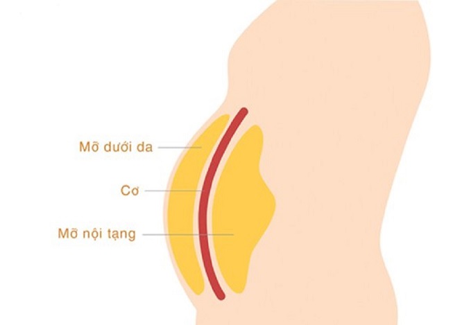 Mỡ nội tạng - Vị trí các loại mỡ thừa tích tụ ở bụng